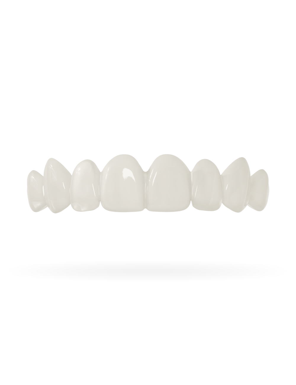 Tand-Veneer 3.0