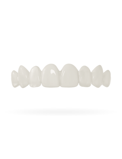Tand-Veneer 3.0
