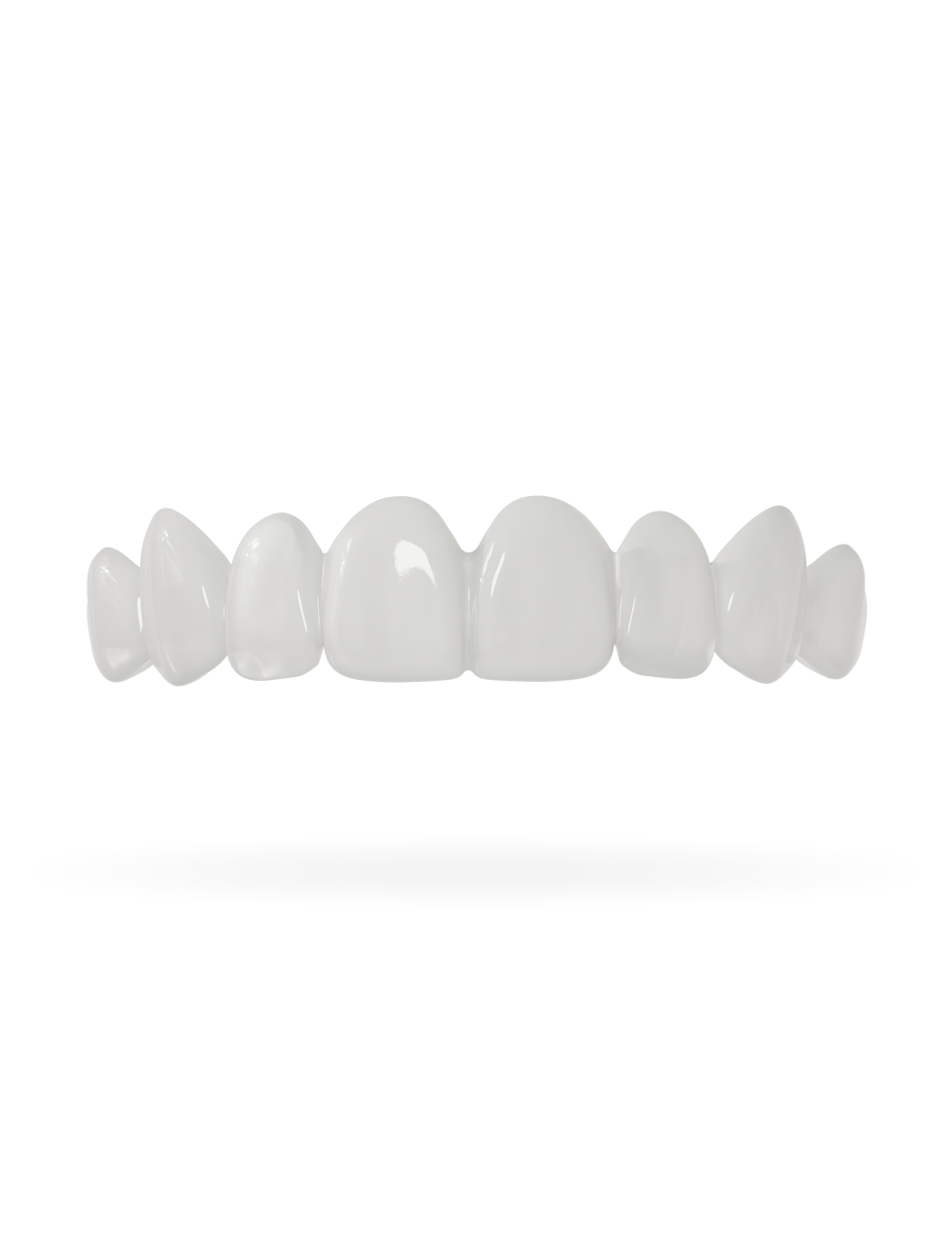 Tand-Veneer 3.0