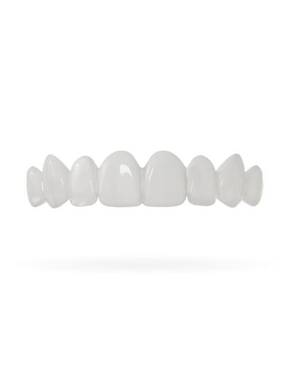 Tand-Veneer 3.0