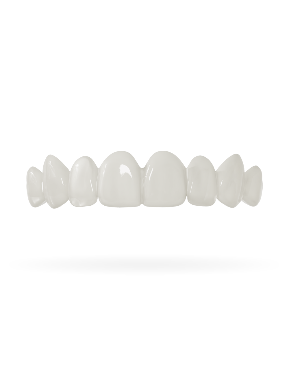 Tand-Veneer 3.0