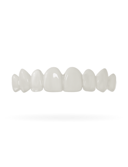 Tand-Veneer 3.0