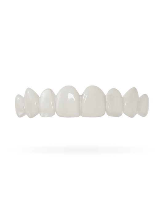 Tand-Veneer 3.0