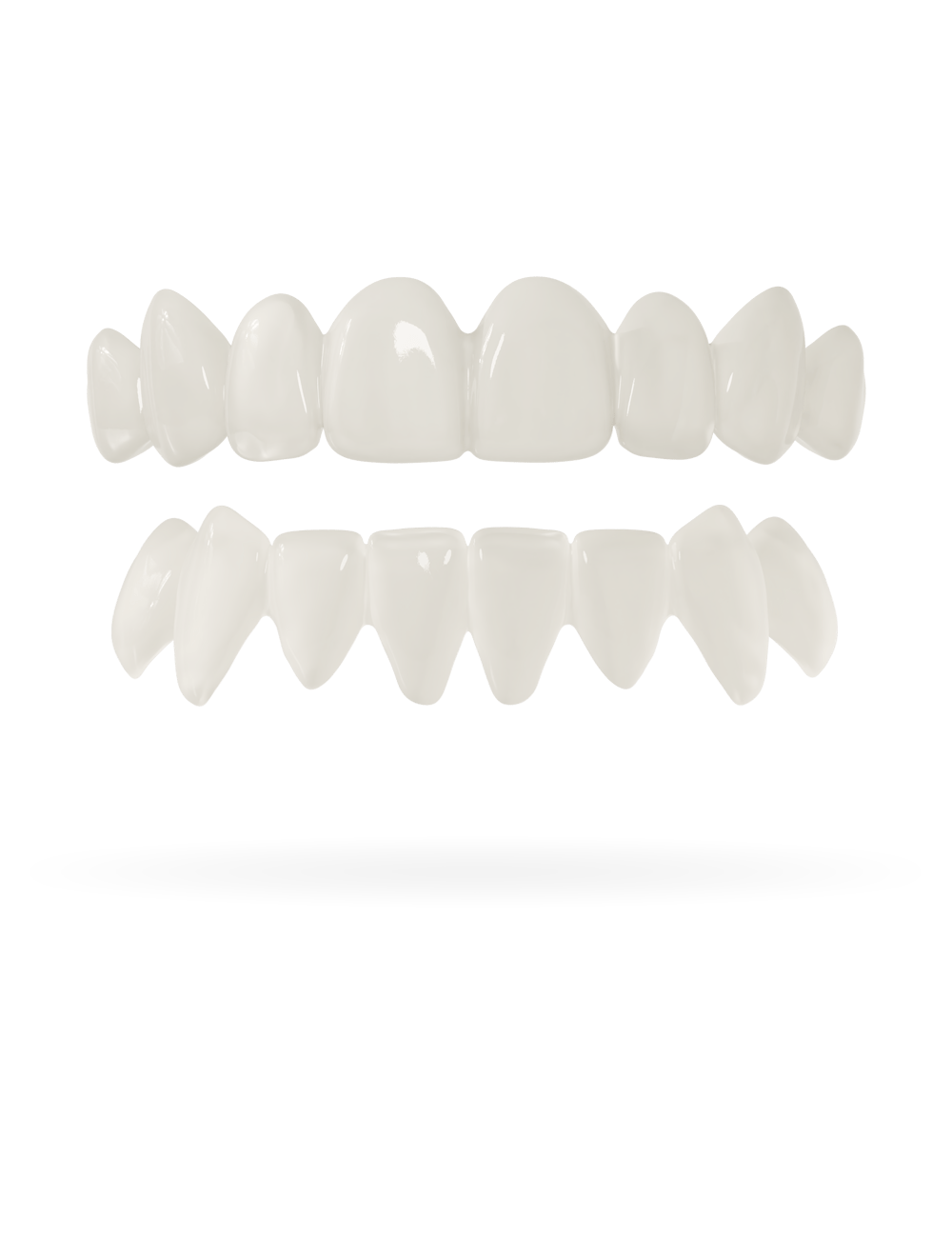 Tand-Veneer 3.0