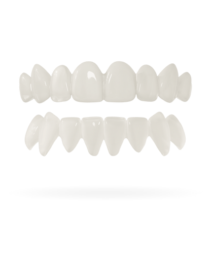 Tand-Veneer 3.0