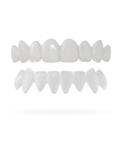 Tand-Veneer 3.0