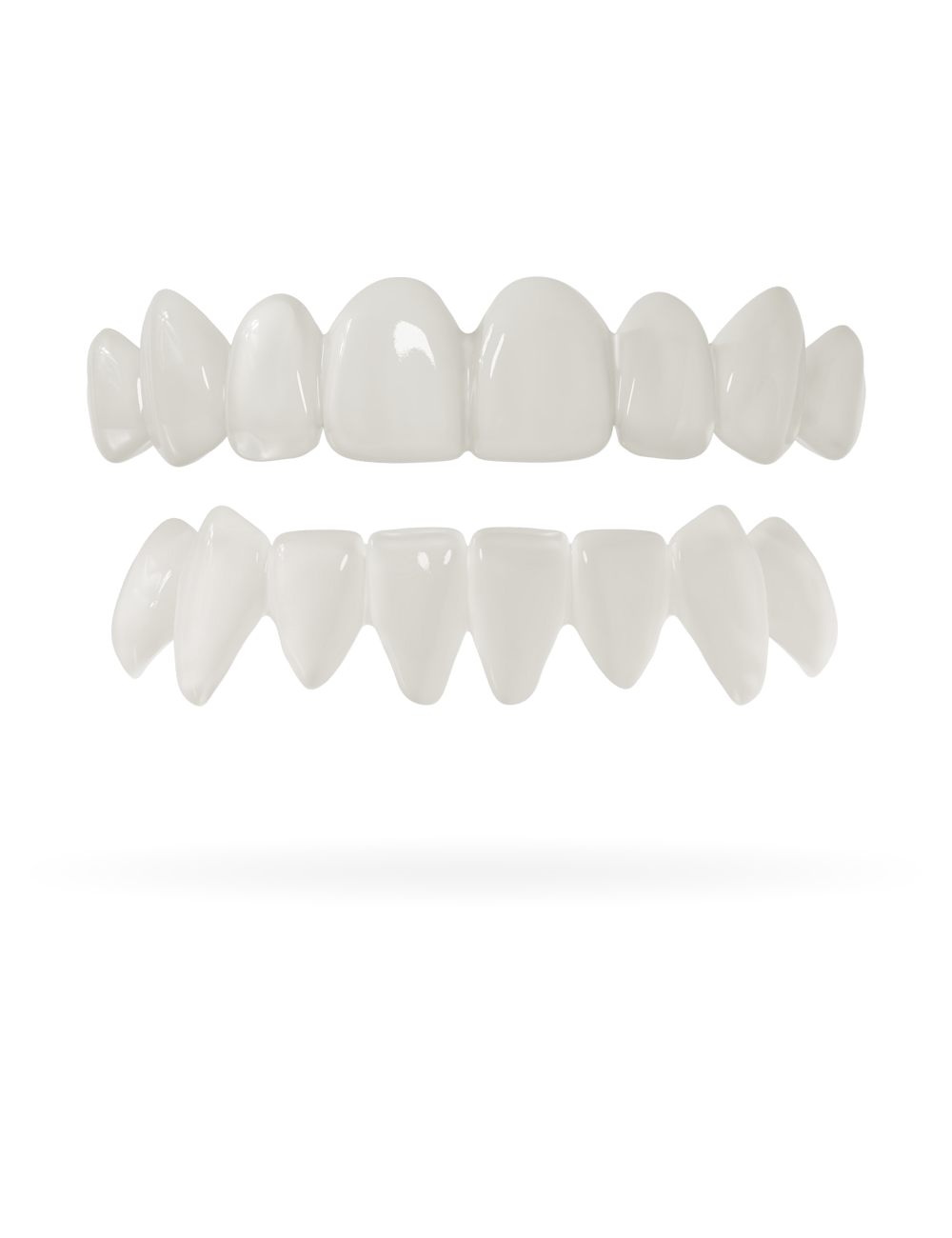 Tand-Veneer 3.0