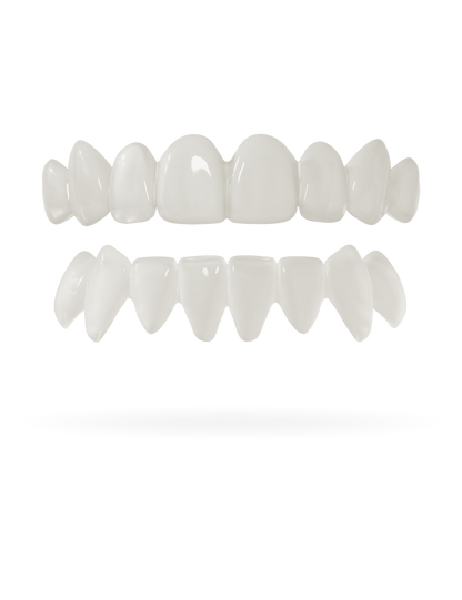 Tand-Veneer 3.0