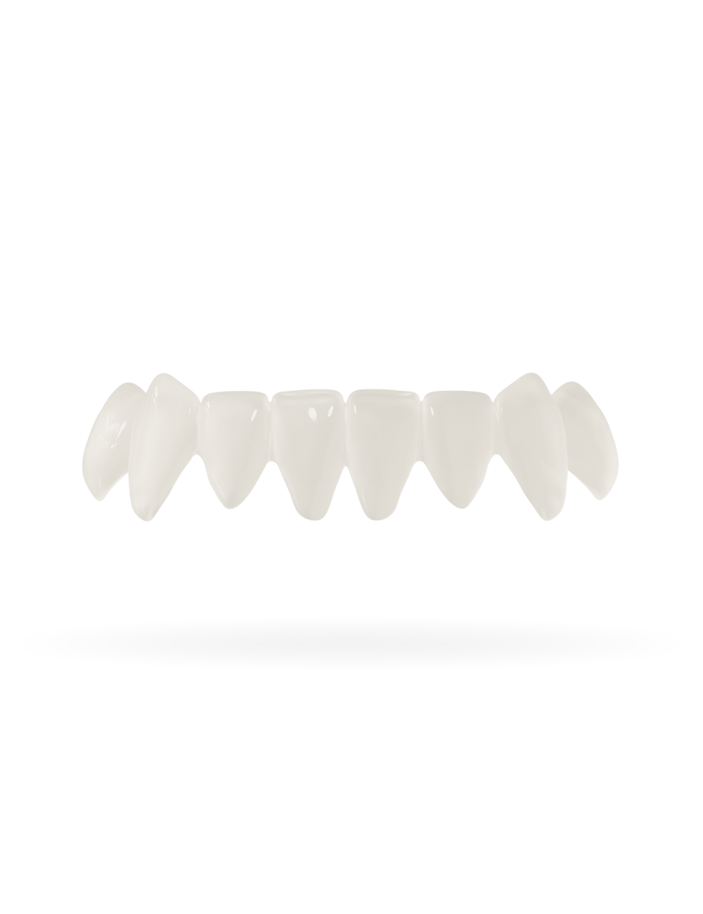 Tand-Veneer 3.0