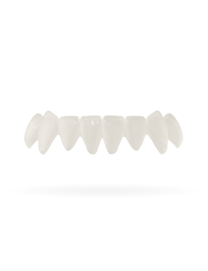 Tand-Veneer 3.0