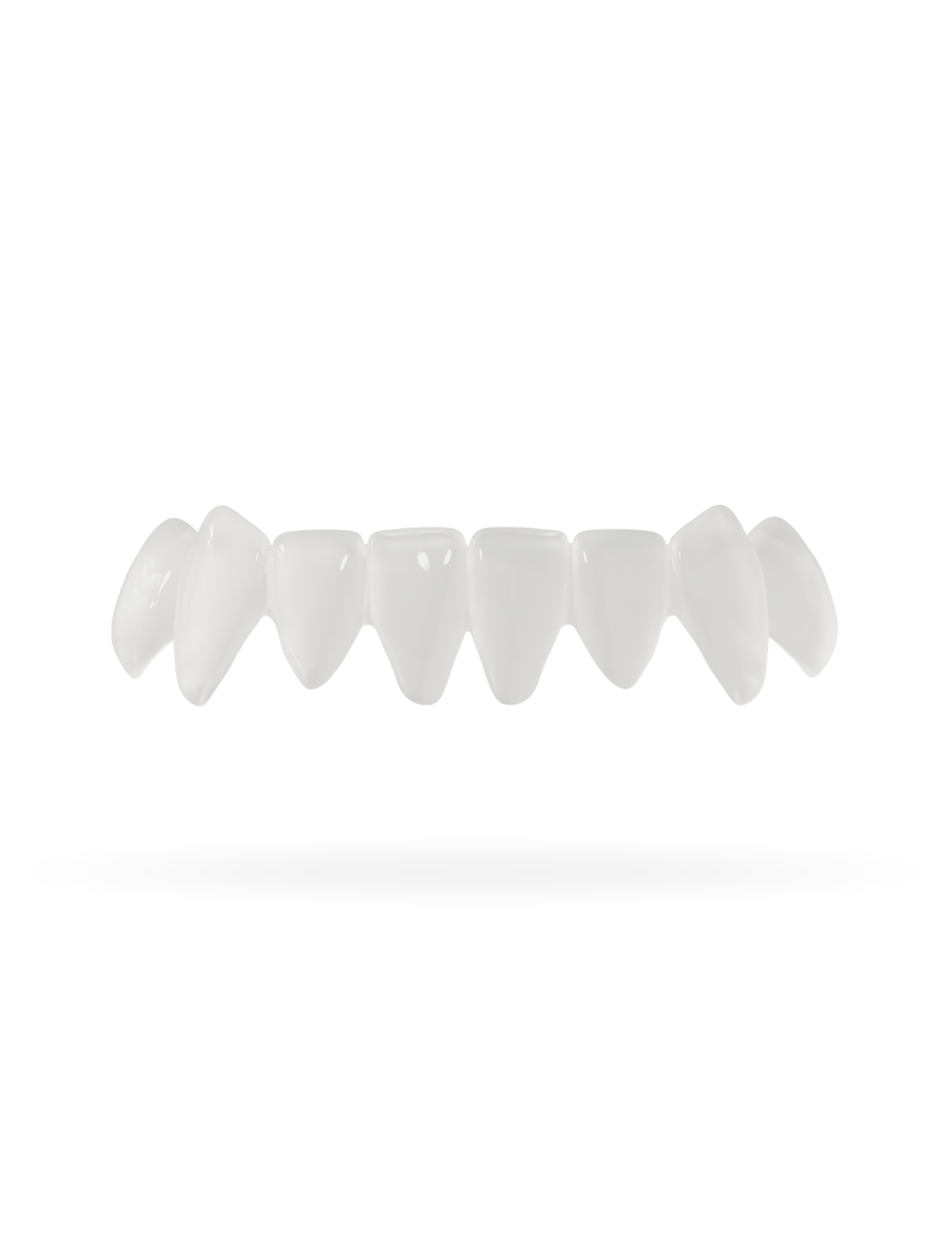 Tand-Veneer 3.0