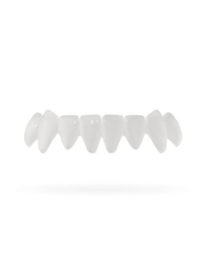 Tand-Veneer 3.0