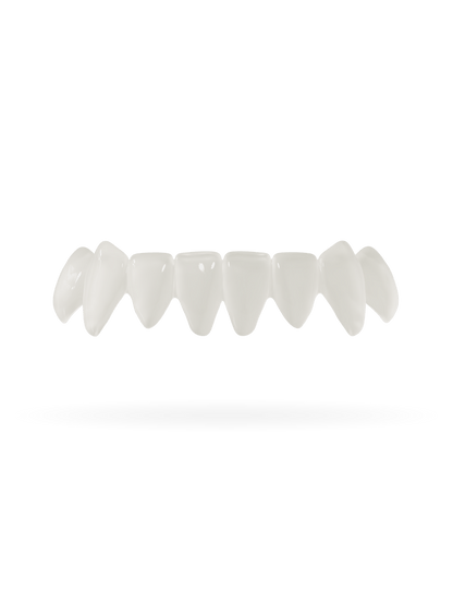 Tand-Veneer 3.0